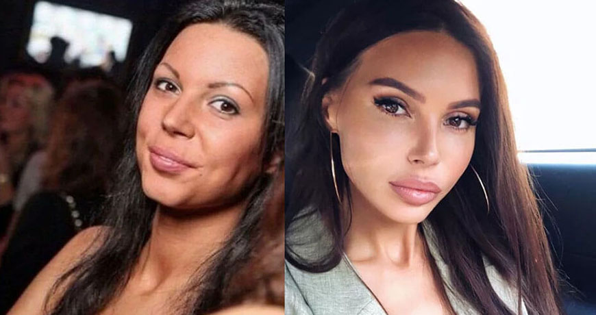 Оксана Самойлова до и после