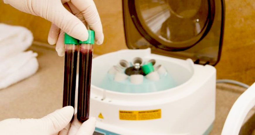 Подготовка к выделению плазмы из крови
