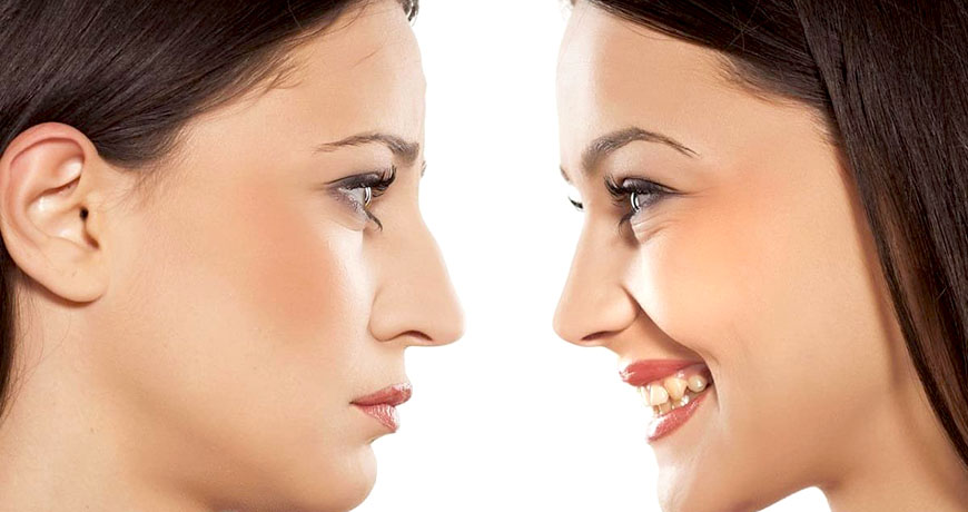 Ринопластика: коррекция формы и размеров носа
