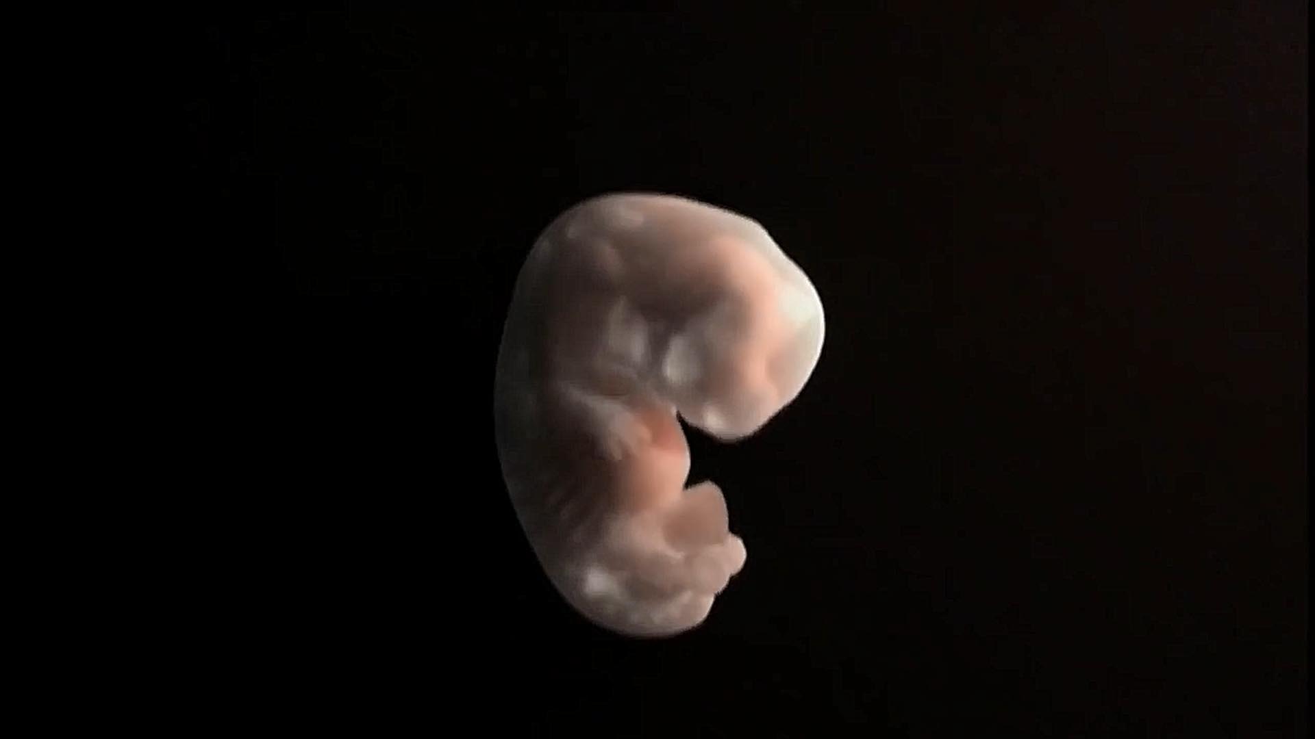 8 недель и 6 дней. Эмбрион на 8 неделе беременности. Зародыш человека 7 недель.